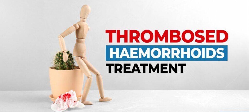 Thrombosed haemorrhoids treatment