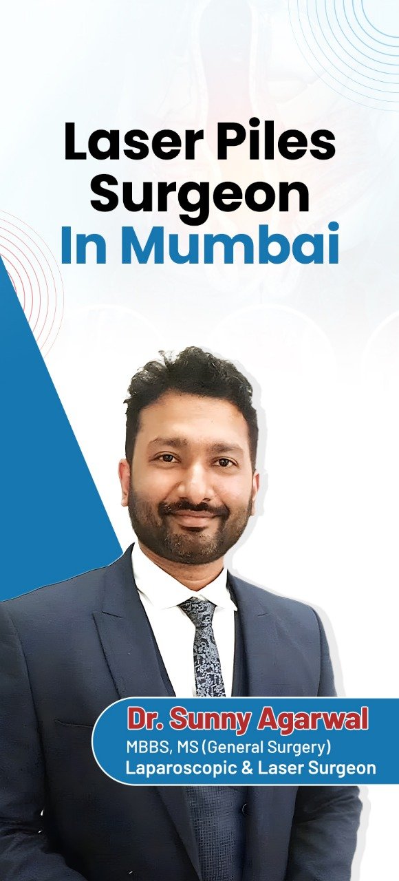 Laser Piles Surgeon in Mumbai – Dr. Sunny Agarwal