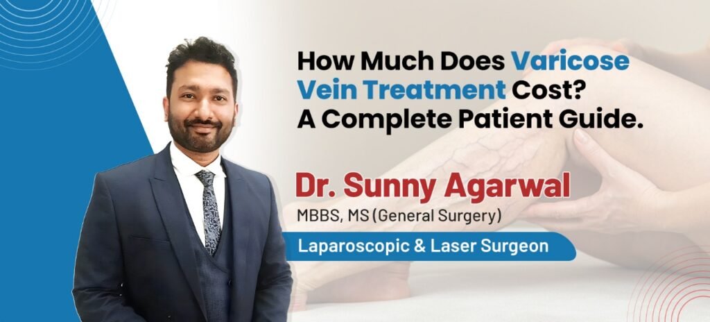 How Much Does Varicose Vein Treatment Cost? A Complete Patient Guide