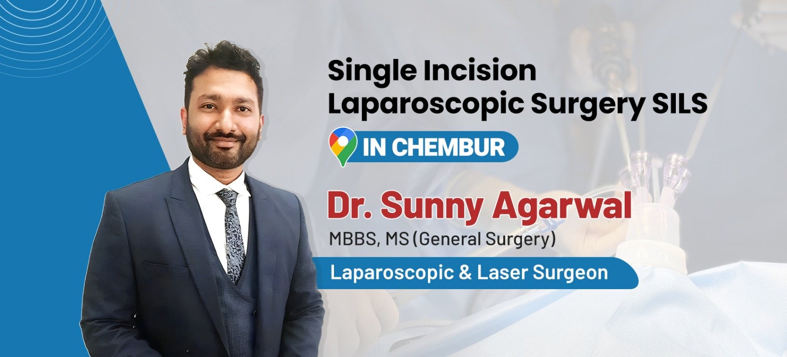 Single Incision Laparoscopic Surgery